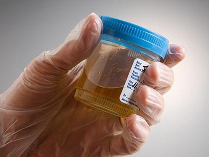 Urinalysis Technology for Institutional Use